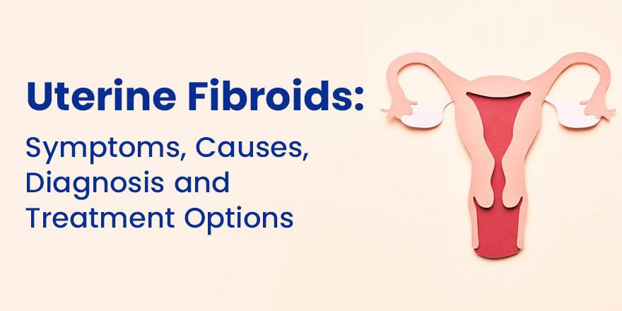 Uterine Fibroids: Symptoms, Causes, Diagnosis and Treatment Options